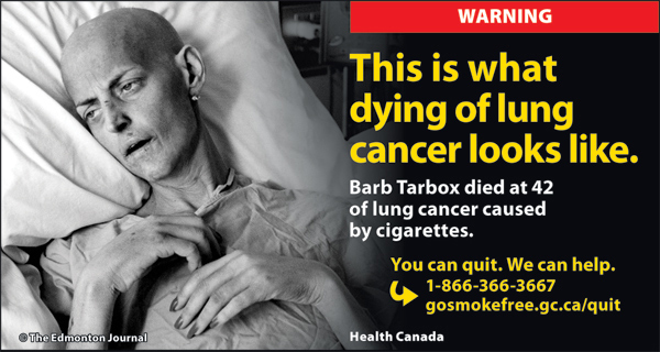 Cigarette label warning - this is what dying of lung cancer looks like